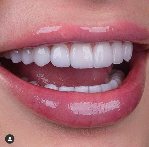 Dazzling White blanqueamiento dental